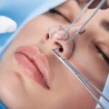 Why Choose The Best Rhinoplasty Specialist In Beverly Hills CA For Your Surgery